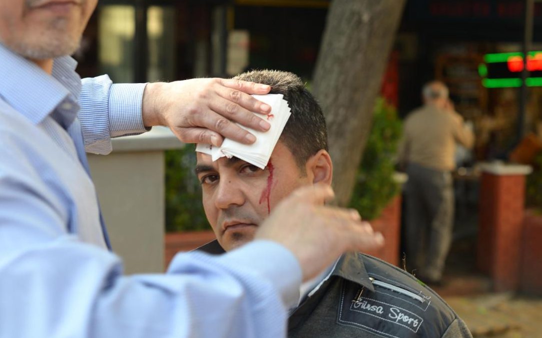 Photo: Onur Yurtsever/AFP/Getty Images